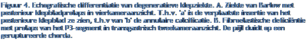 Tekstvak: Figuur 4. Echografische differentiatie van degeneratieve klepziekte. A. Ziekte van Barlow met posterieur klepbladprolaps in vierkameraanzicht. T.h.v. 'a' is de verplaatste insertie van het posterieure klepblad ze zien, t.h.v van 'b' de annulaire calcificatie. B. Fibroelastische deficintie met prolaps van het P3-segment in transgastrisch tweekameraanzicht. De pijl duidt op een geruptureerde chorda.
