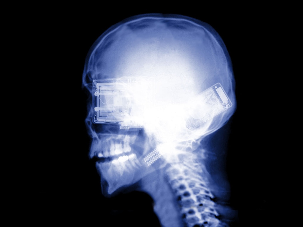 X-RaySkull.jpg