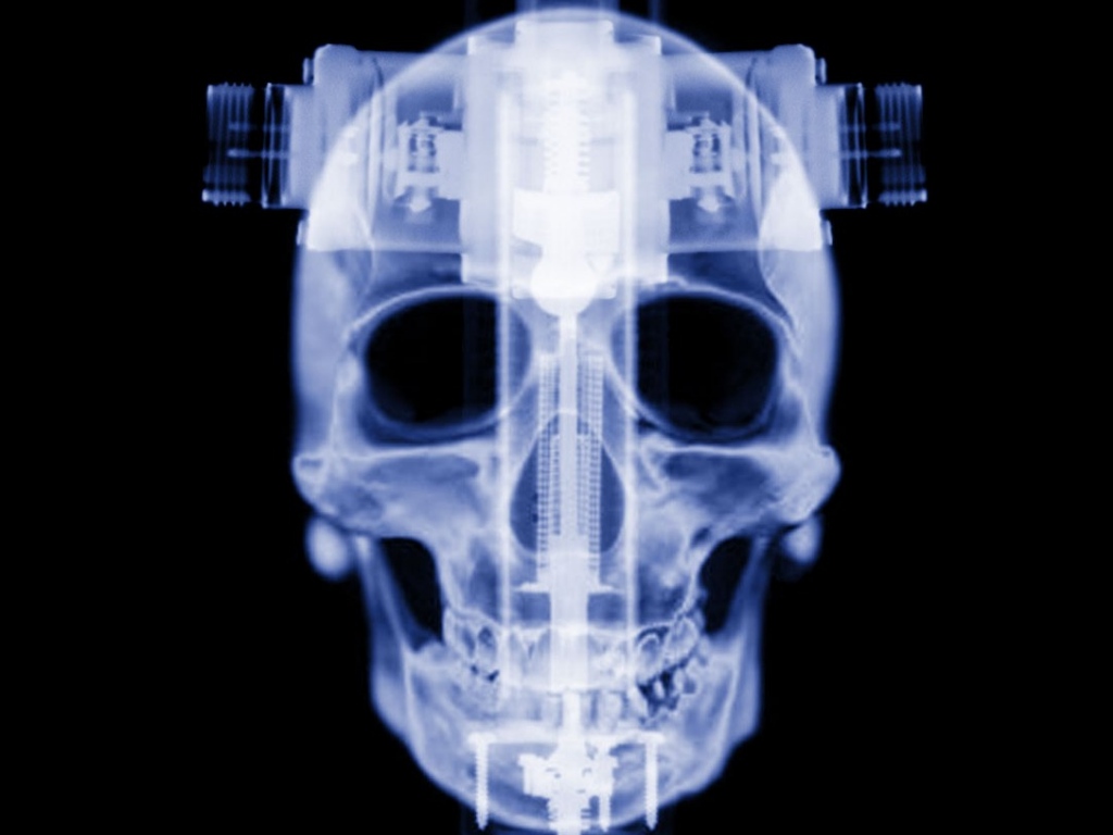 X-RaySkull02.jpg