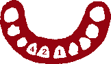 Onderkaak